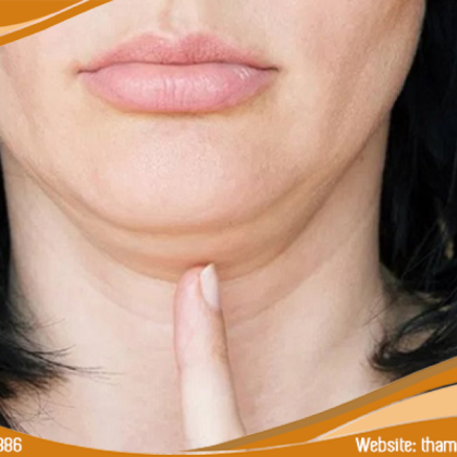 Dịch Vụ Hifu Nọng Cằm