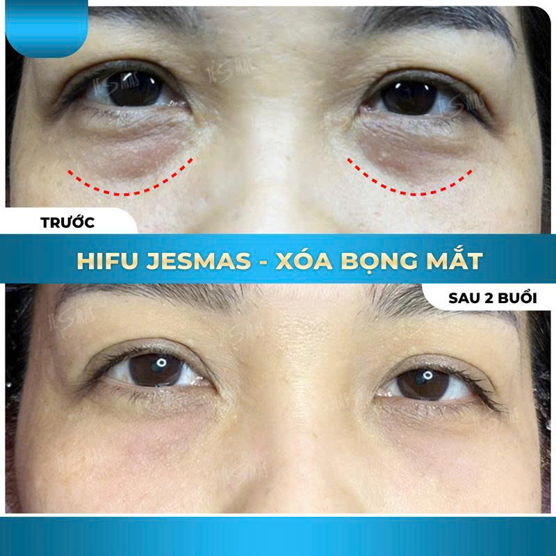 bongmatxanhnhat