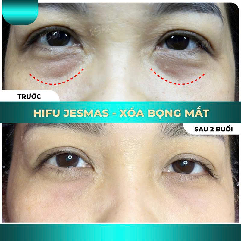 bongmatxanhnhat2