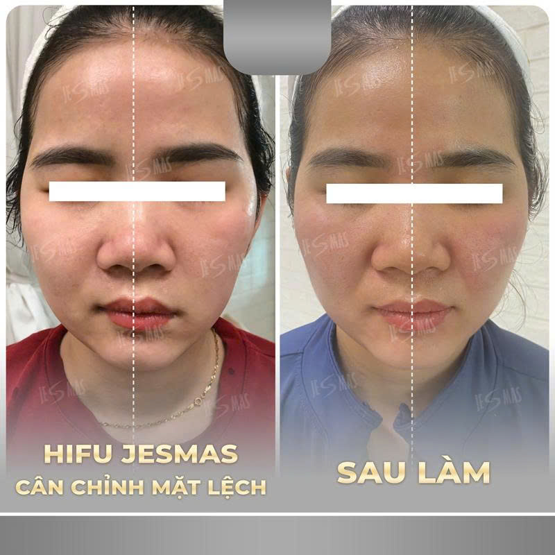 canmatlechxam