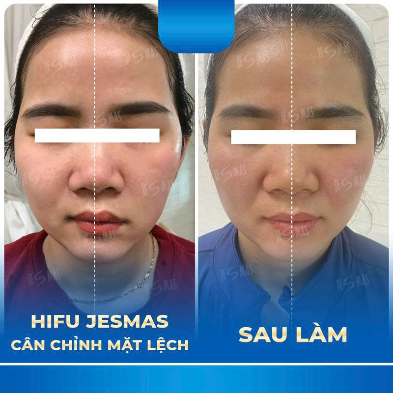 matlechxanhdam