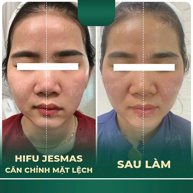 canmatlechxanhdam2