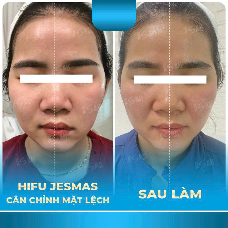 canmatlechxanhnhat