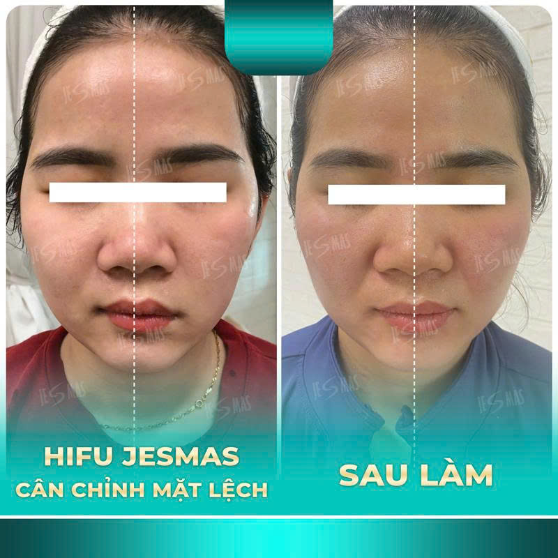 canmatlechxanhnhat2