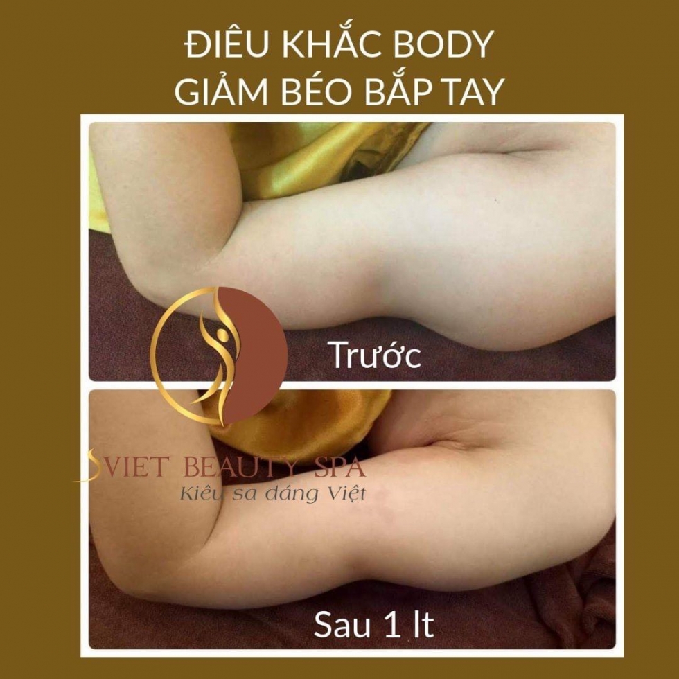 giảm béo tay tại sviet