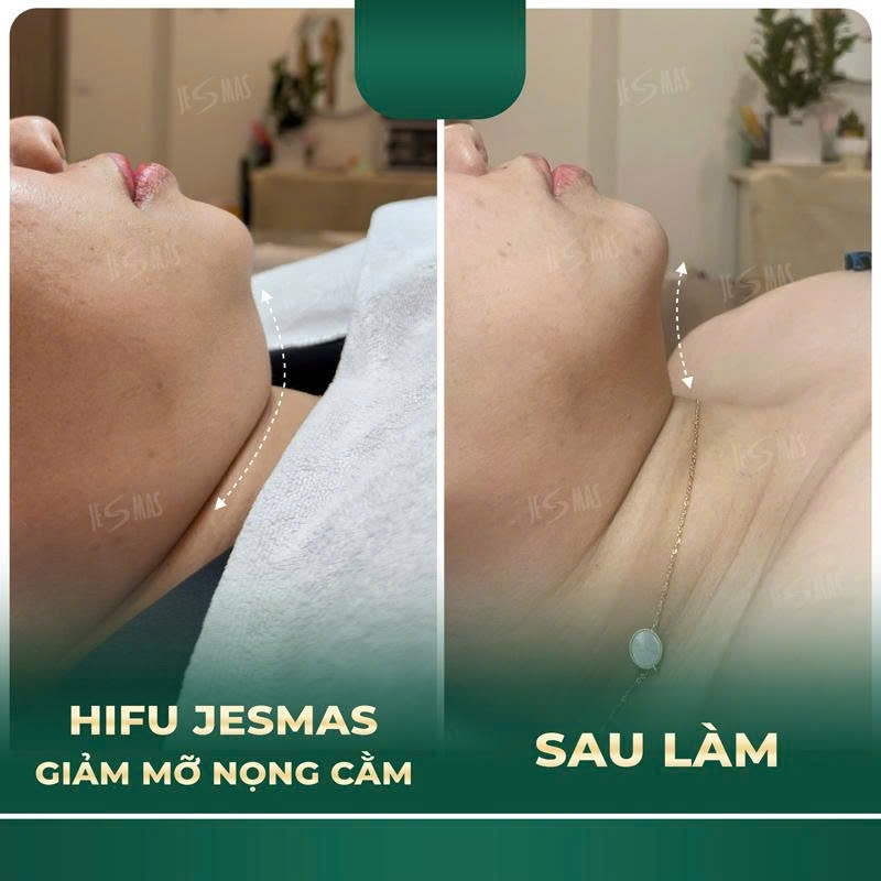 nongcamdam2