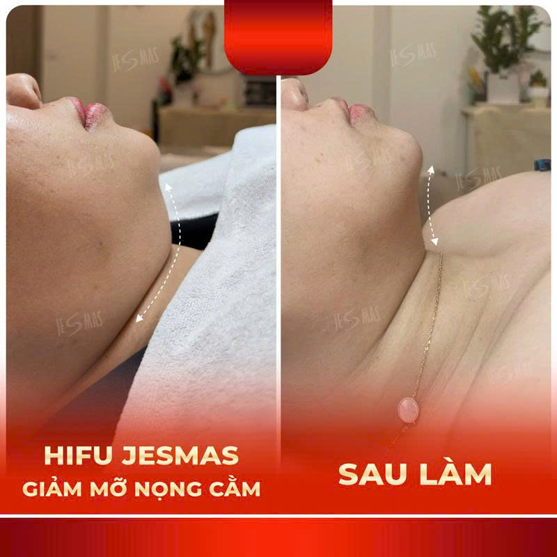 nongcamdo