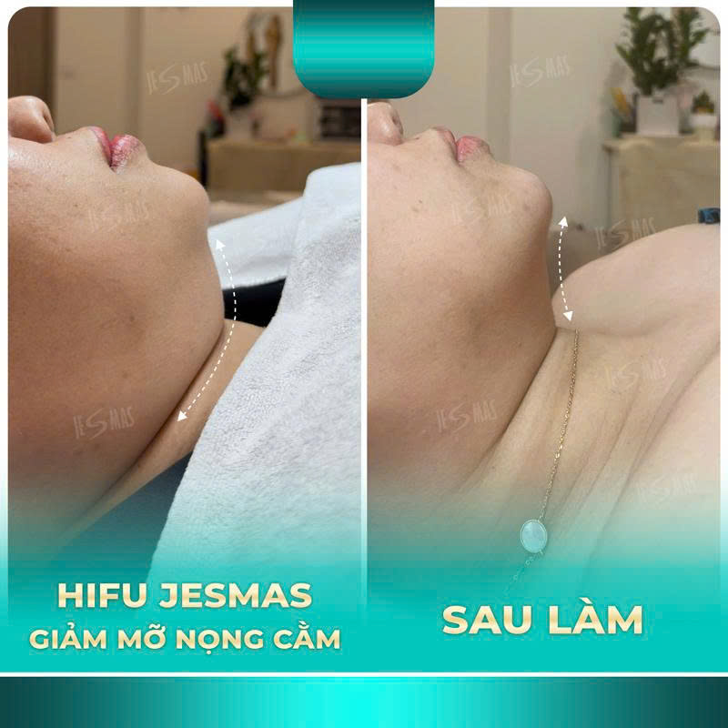 nongcamnhat2