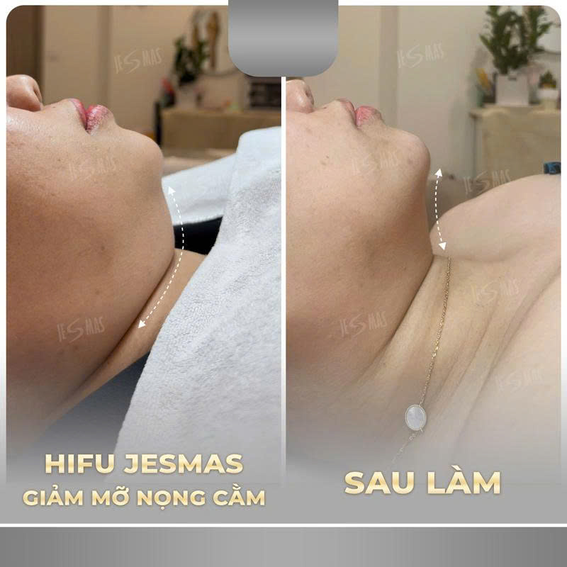 nongcamxam
