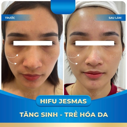 TĂNG SINH - TRẺ HÓA DA