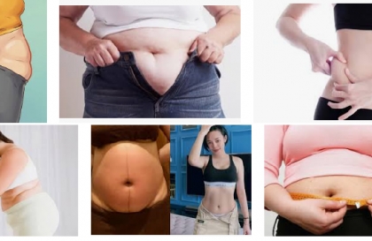 Tìm hiểu về 4 dạng mỡ trong cơ thể và giải pháp giảm béo hiệu quả