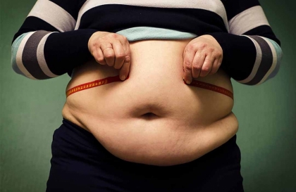 Tác hại của béo phì đối với sức khoẻ cơ thể