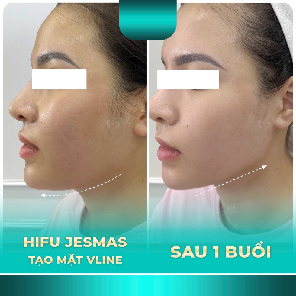 hifitaomatvlinexanhnhat2