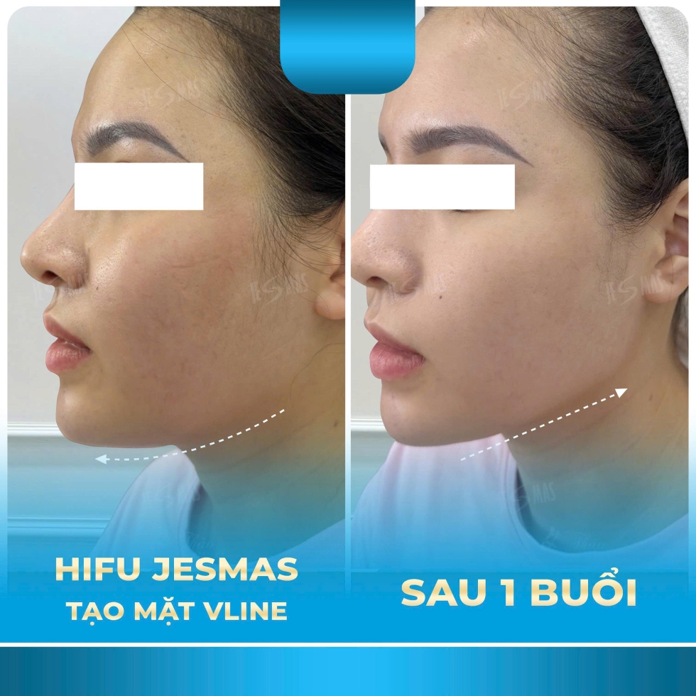 hifitaomatvlinexanhnhat