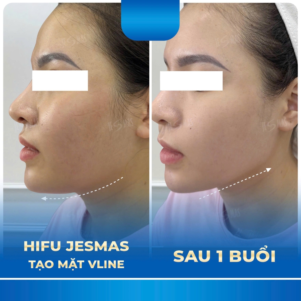 hifitaomatvlinexanhdam
