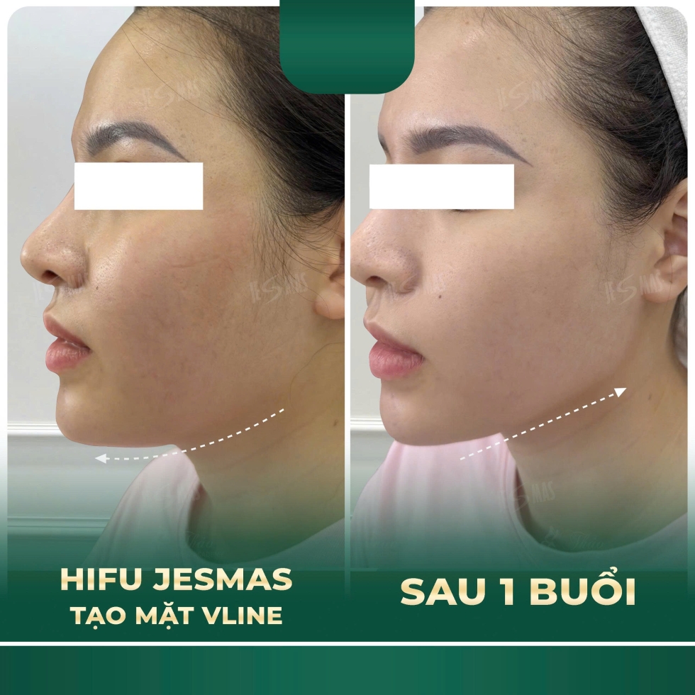 hifitaomatvlinexanhdam2