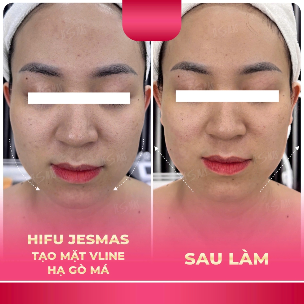 hifutaohinhvlinehagomahong