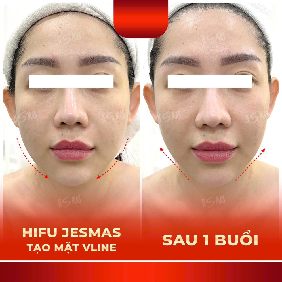 hifujesmastaomatvlinedo