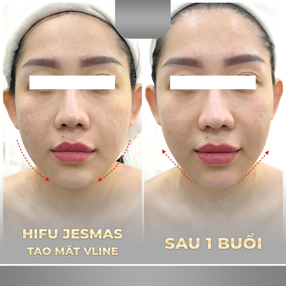hifujesmastaomatvlinexam