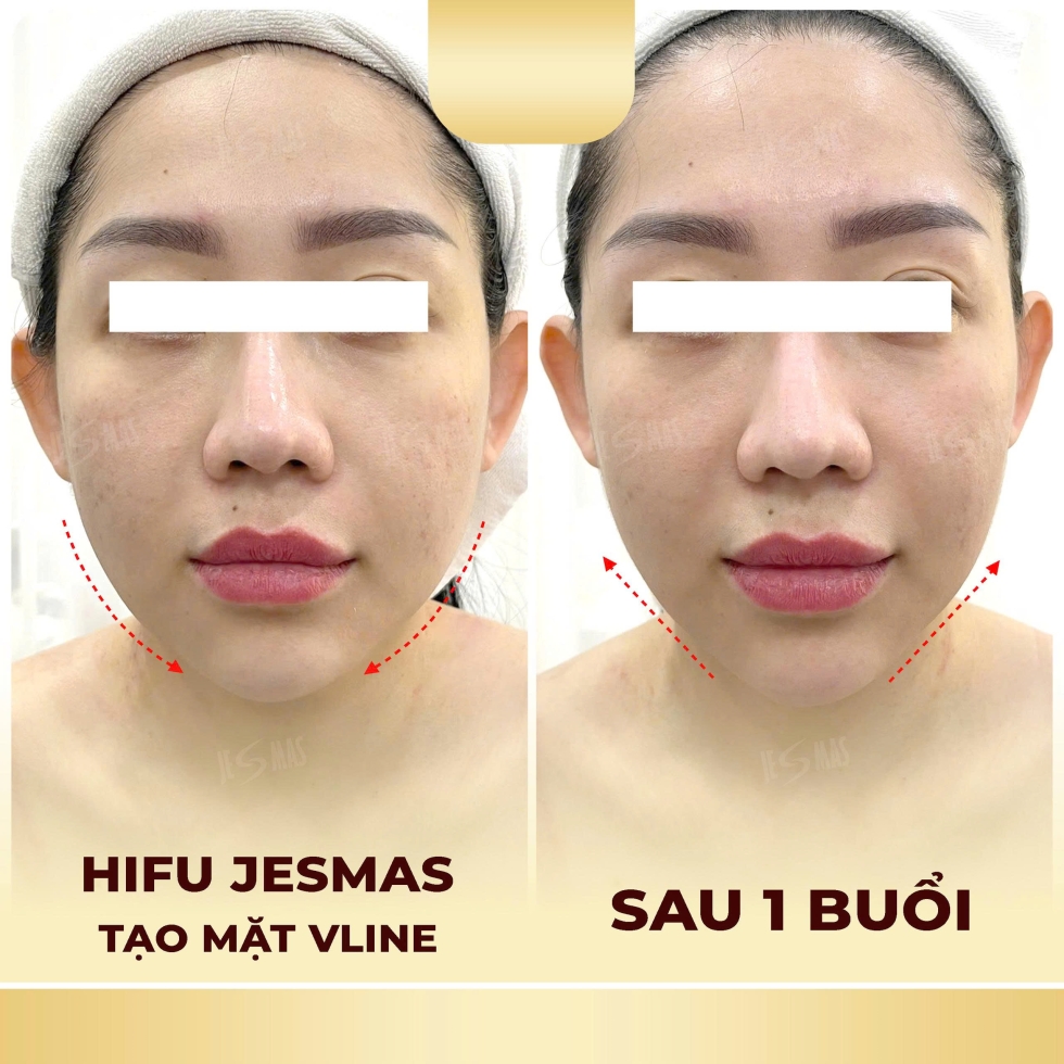 hifujesmastaomatvlinevang