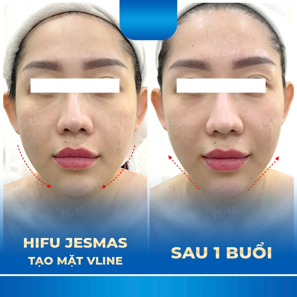 hifutaomatvlinexanhdam