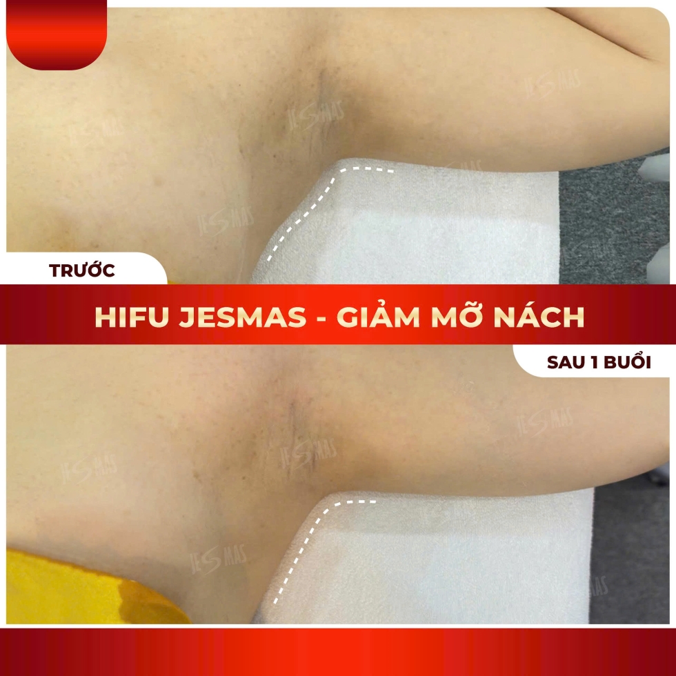 hifugiammanachdo