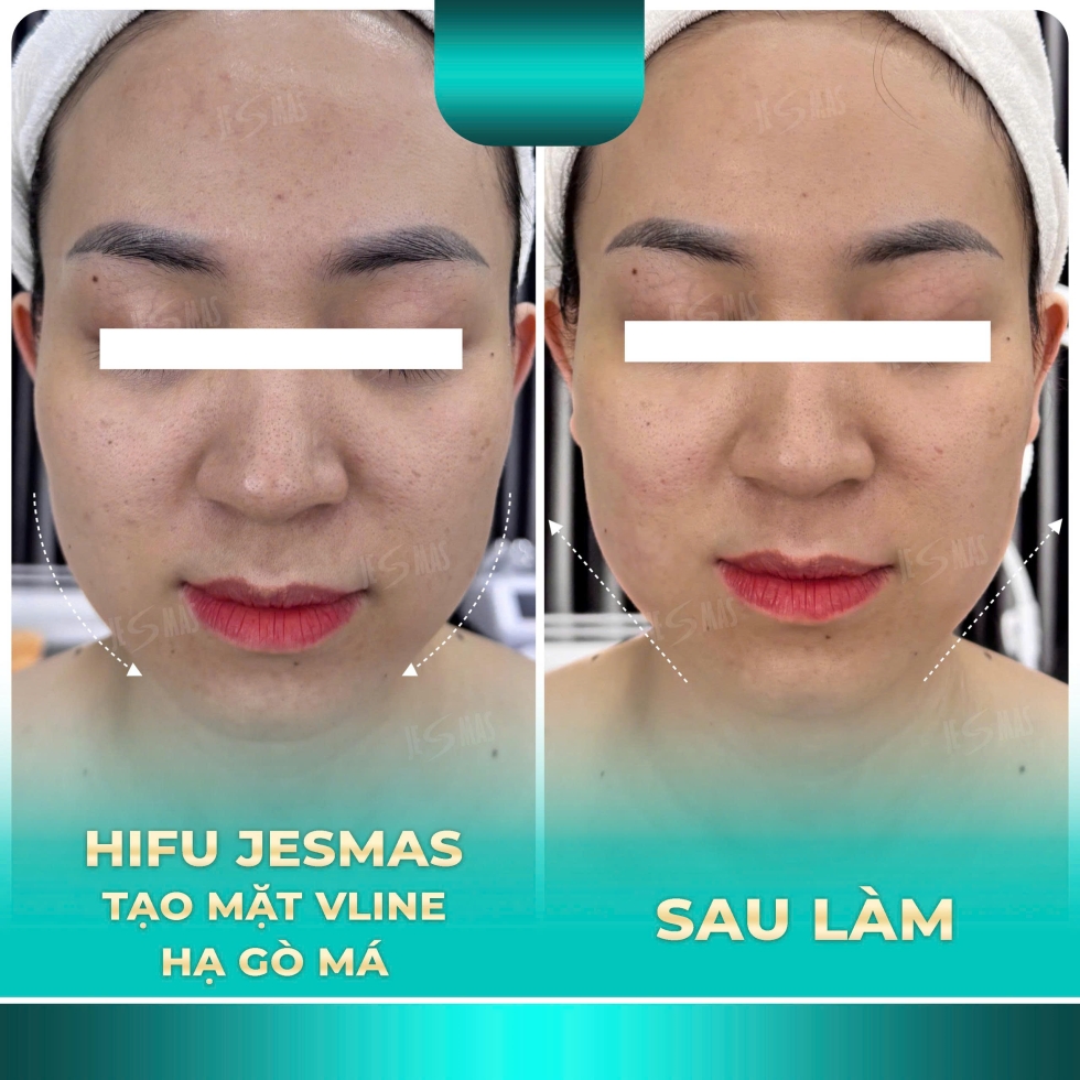 hifutaohinhvlinehagomaxanhnhat2