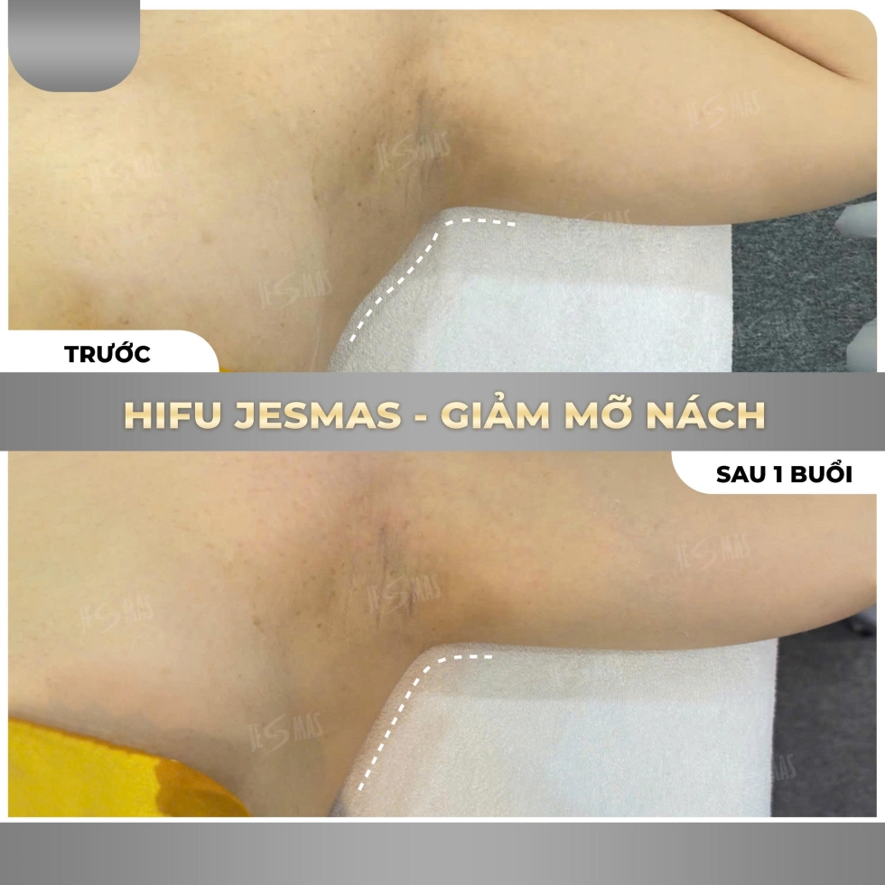 hifugiammanachxam