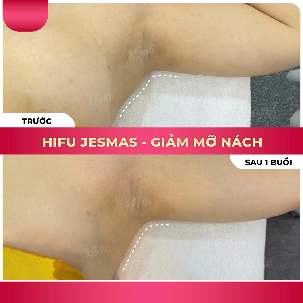 hifugiammanachhong