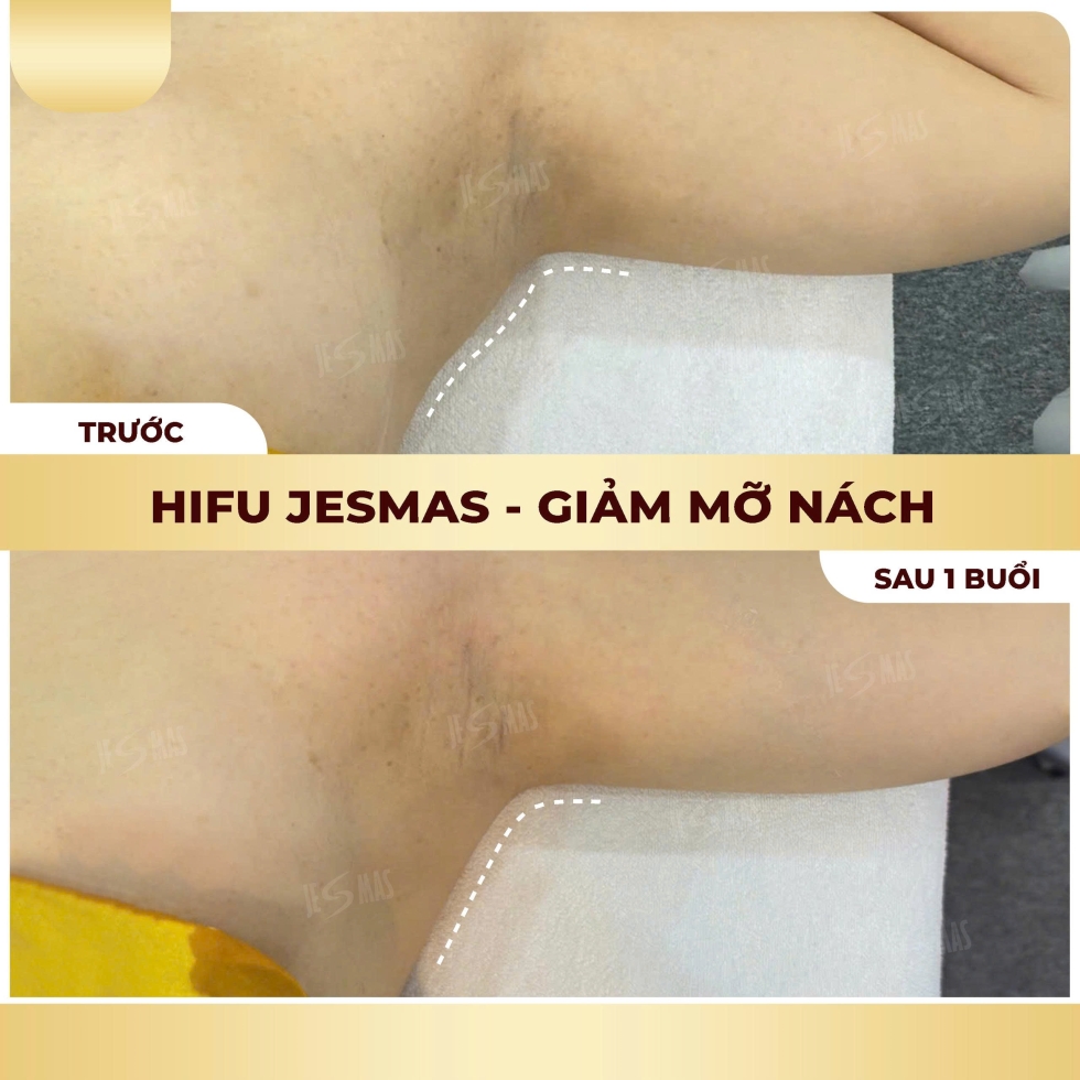 hifugiammanachvang