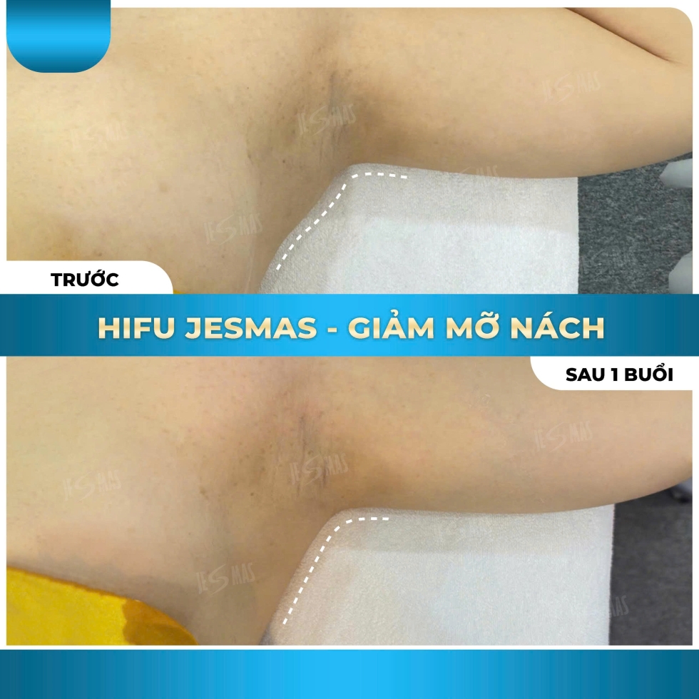 hifugiammanachxanhnhat