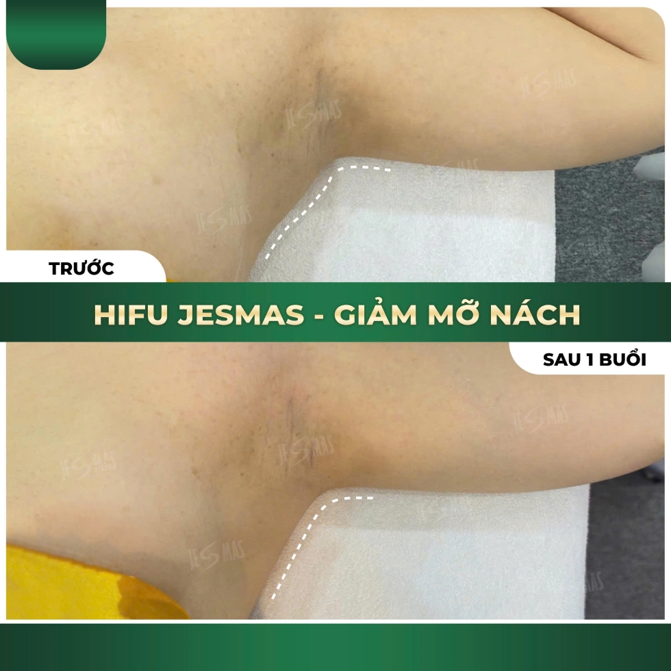 hifugiammanachxanhdam2