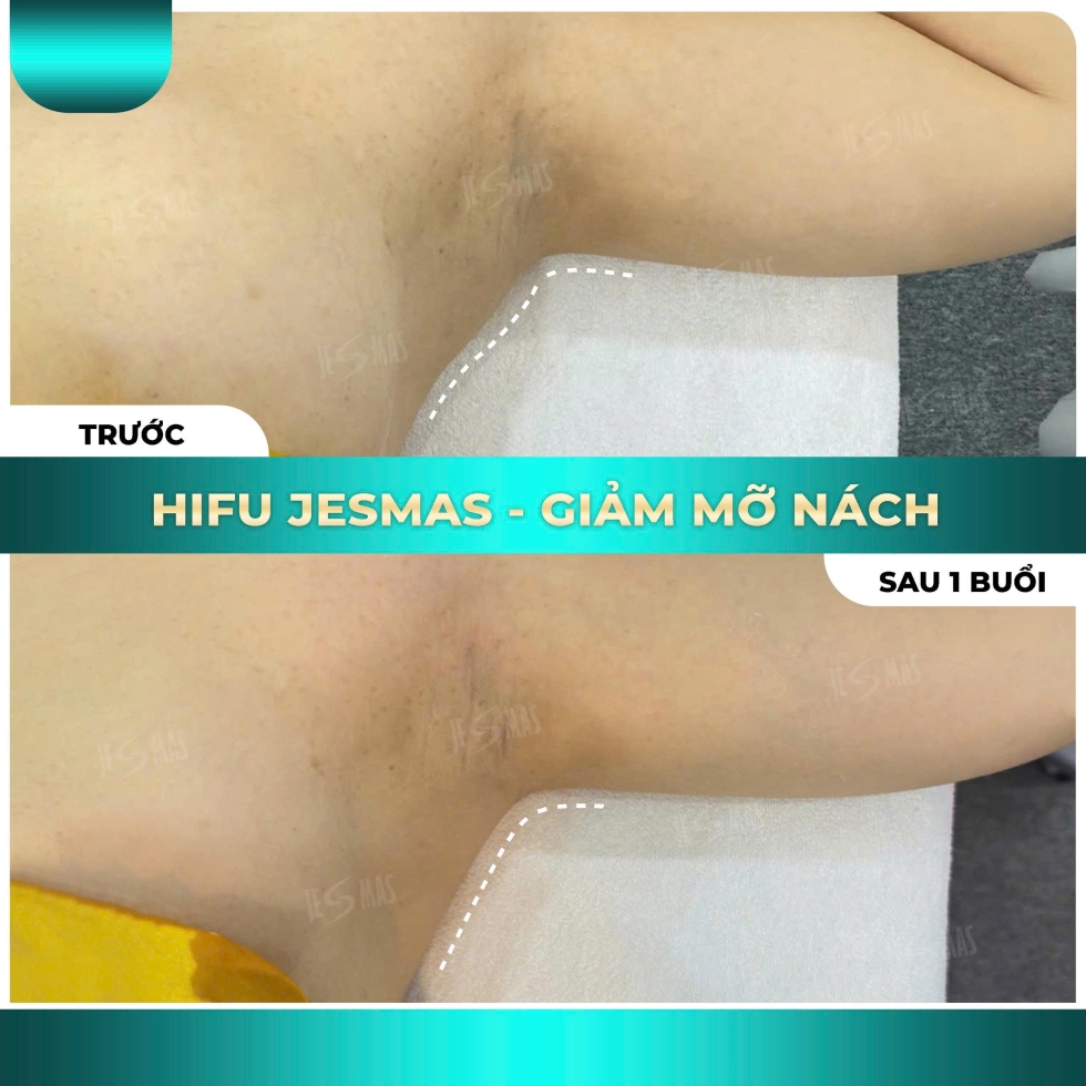 hifugiammanachxanhnhat2