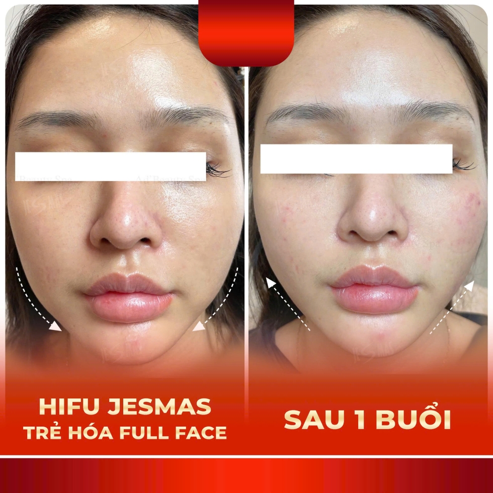 trehoafullface1buoido