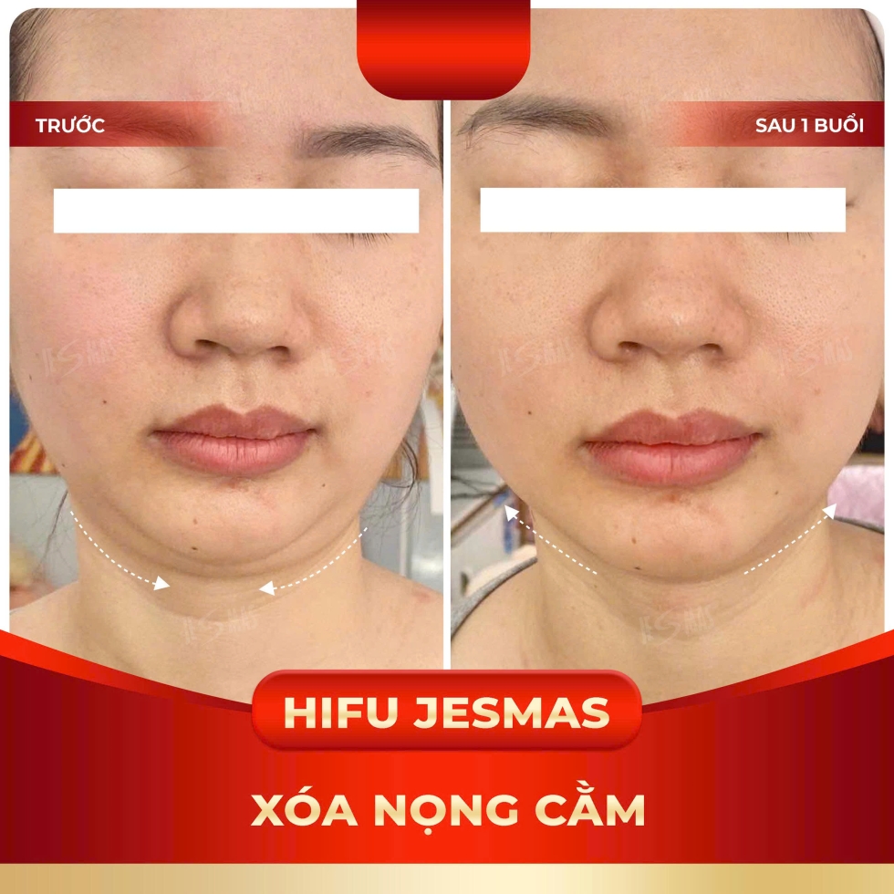 hifujesmasxoanongcamdo