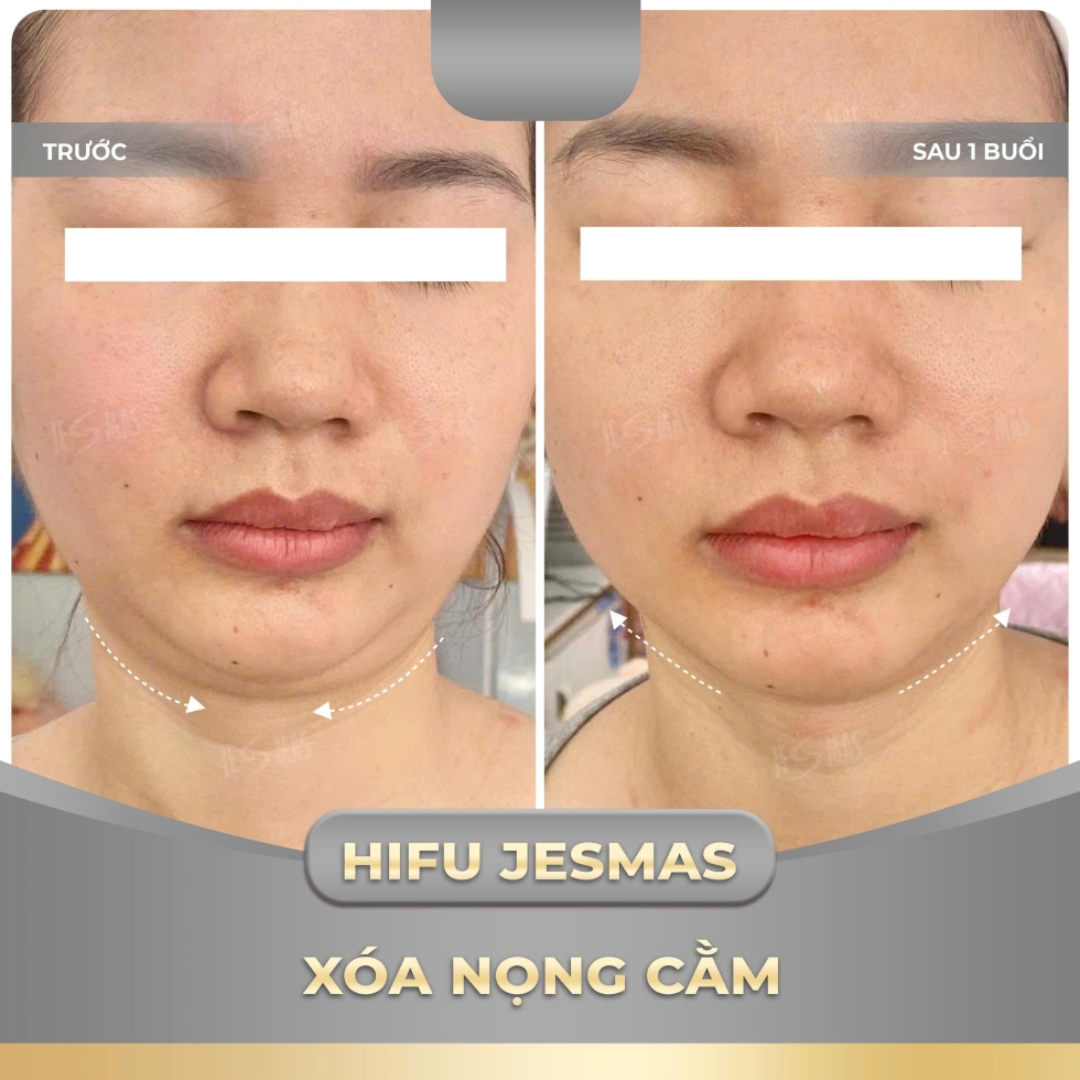 hifujesmasxoanongcamxam