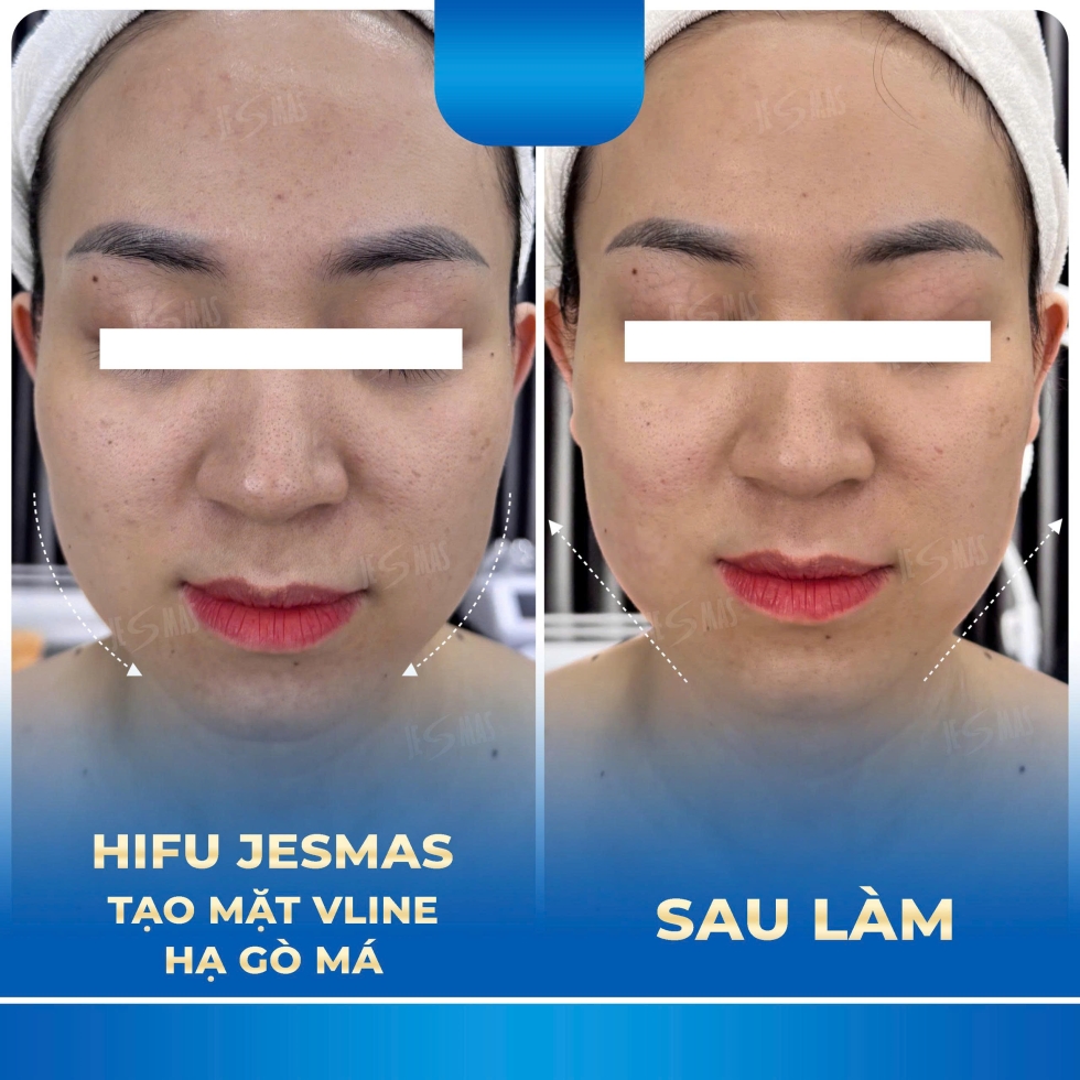 hifutaomatvlinehagomaxanhdam