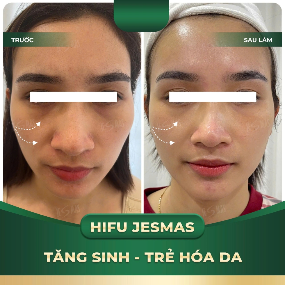 tangsinhtrehoadaxanhdam2