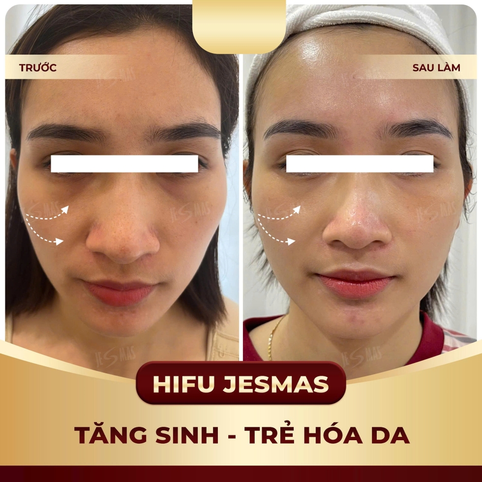 tangsinhtrehoadavang