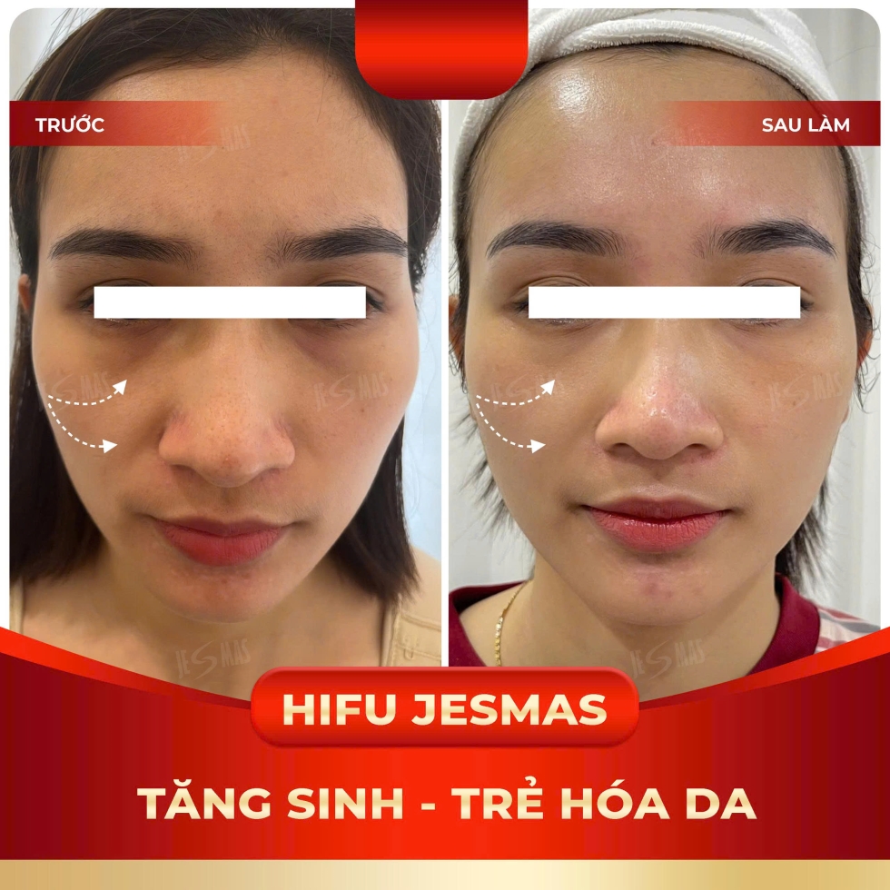 tangsinhtrehoadado
