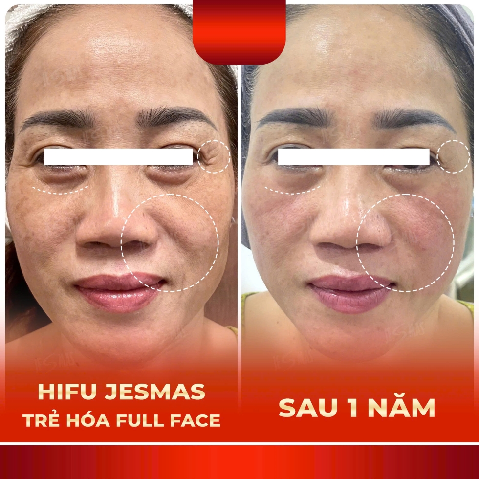 hifujesmastrehoafullfacedo
