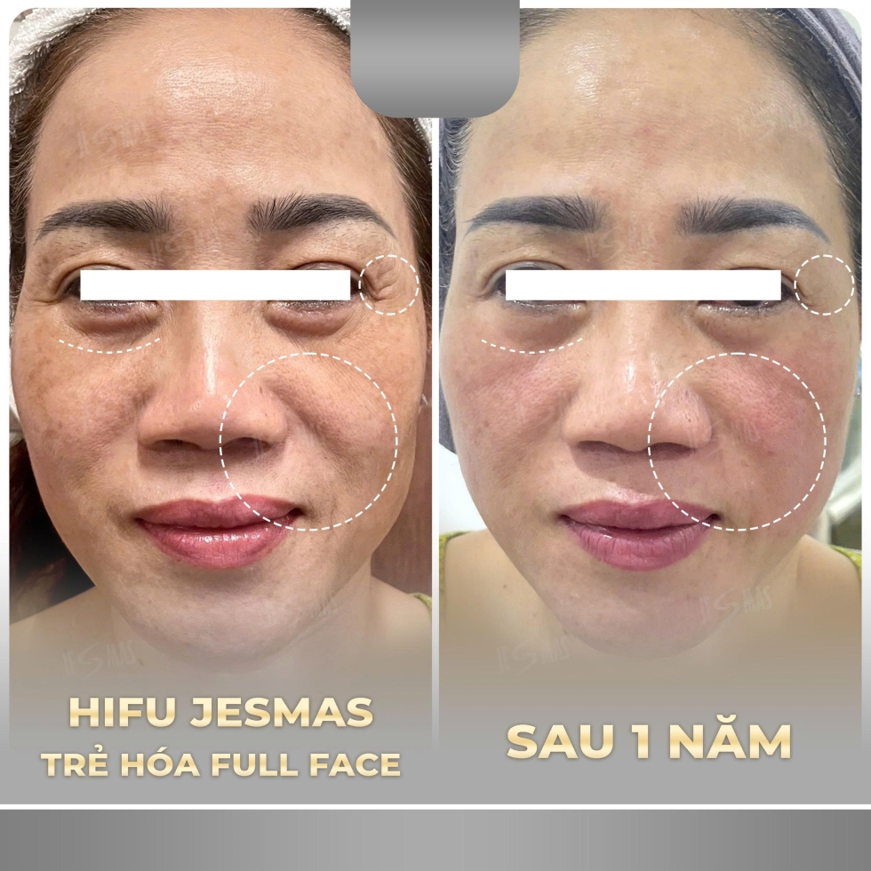 hifujesmastrehoafullfacexam