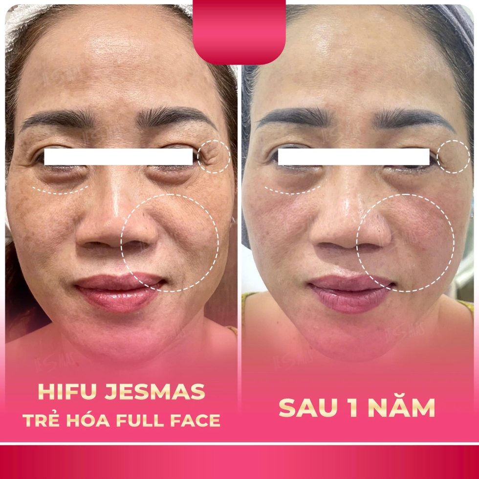 hifujesmastrehoafullfacehong