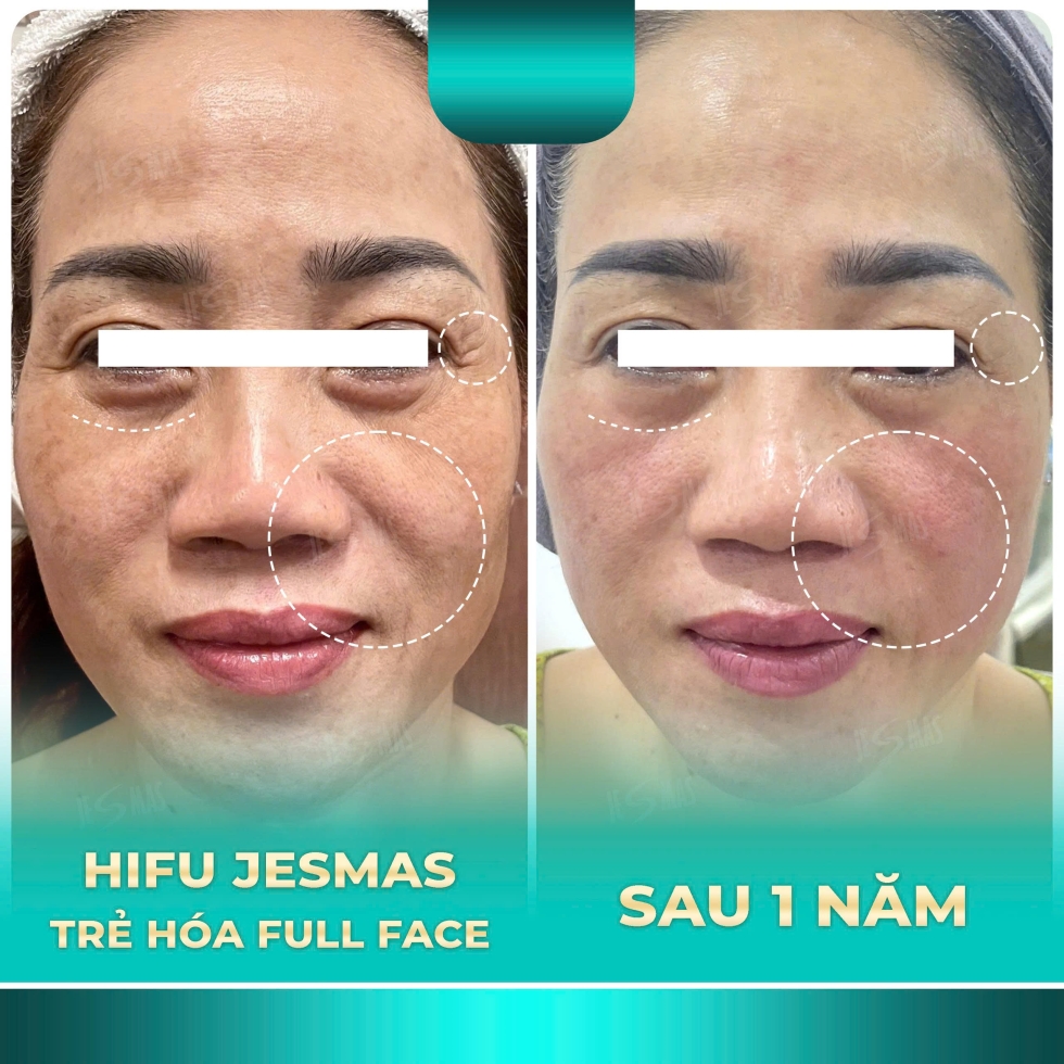 hifujesmastrehoafullfacexanhnhat2
