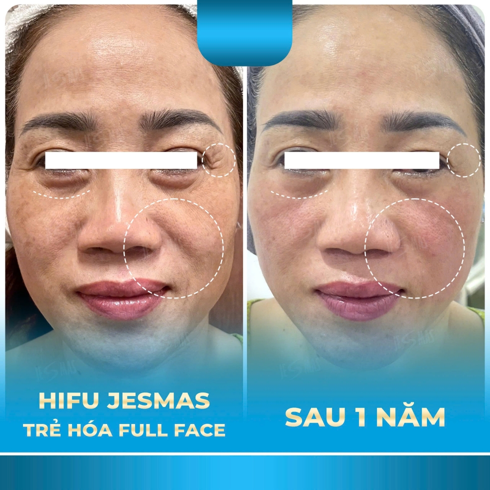 hifujesmastrehoafullfacexanhnhat