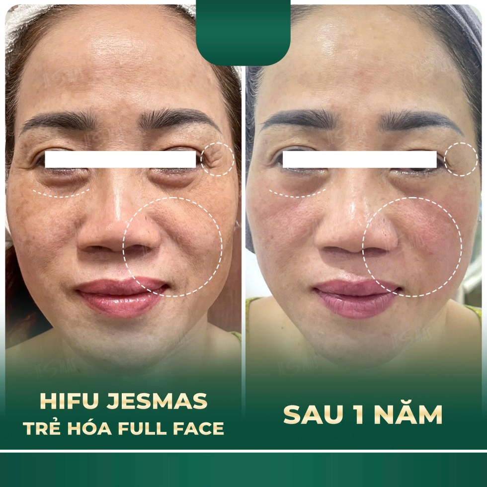 hifujesmastrehoafullfacexanhdam2