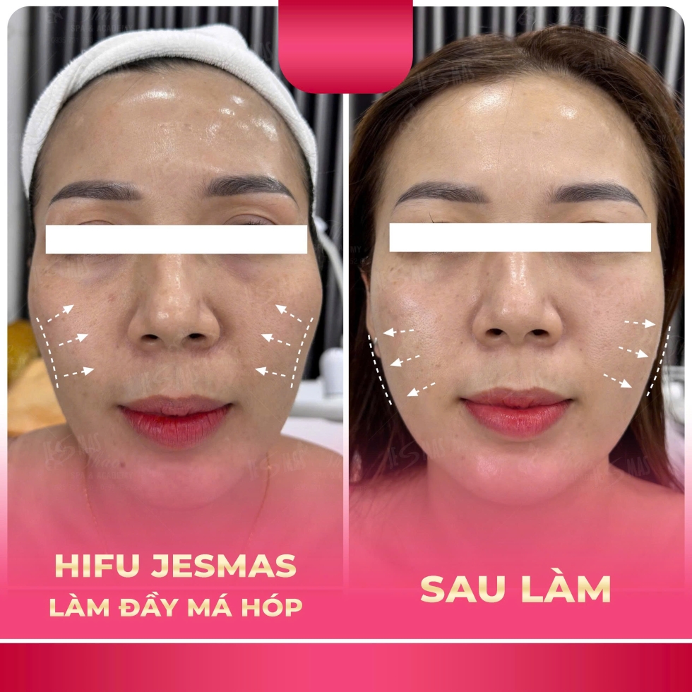hifulamdaymahophong