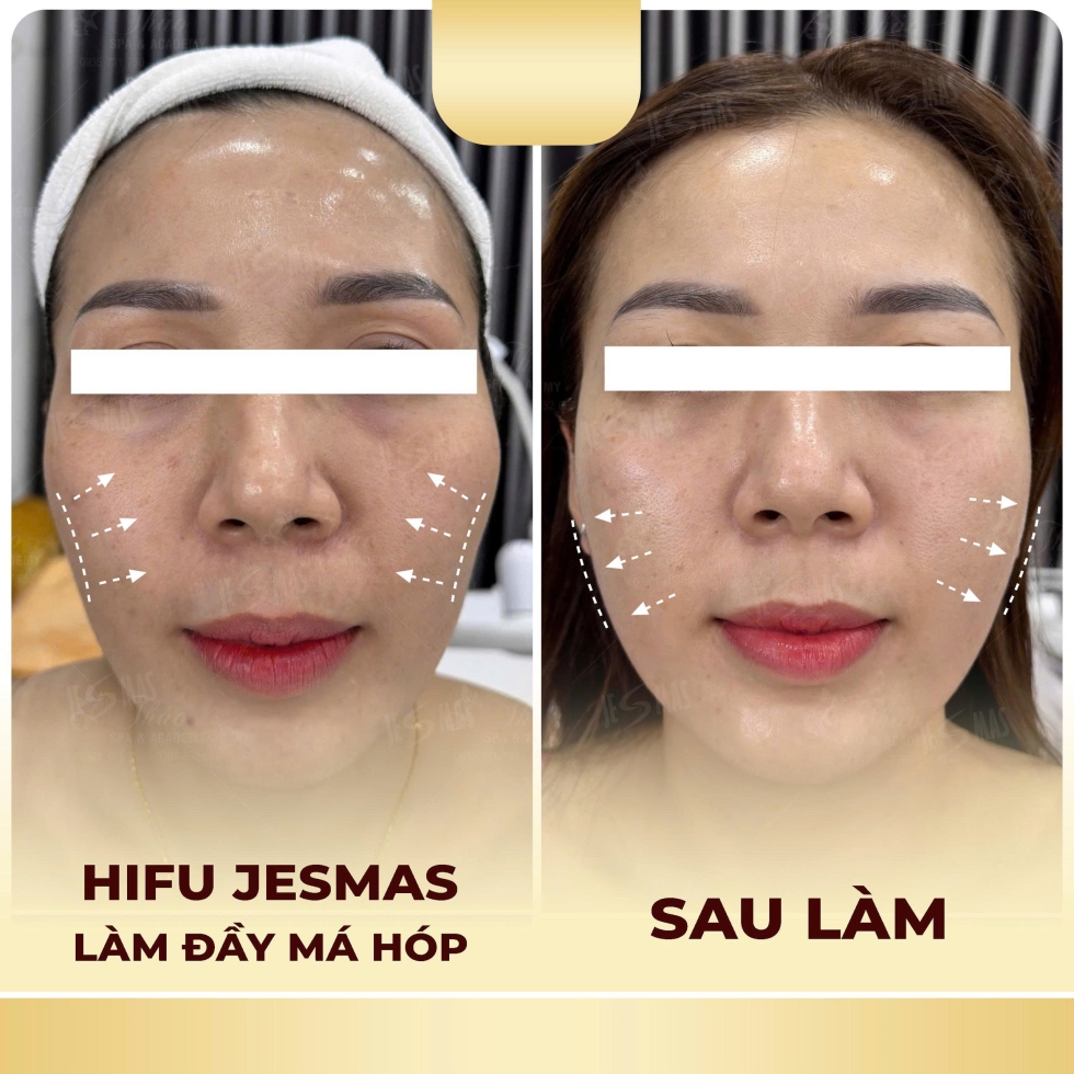 hifulamdaymahopvang