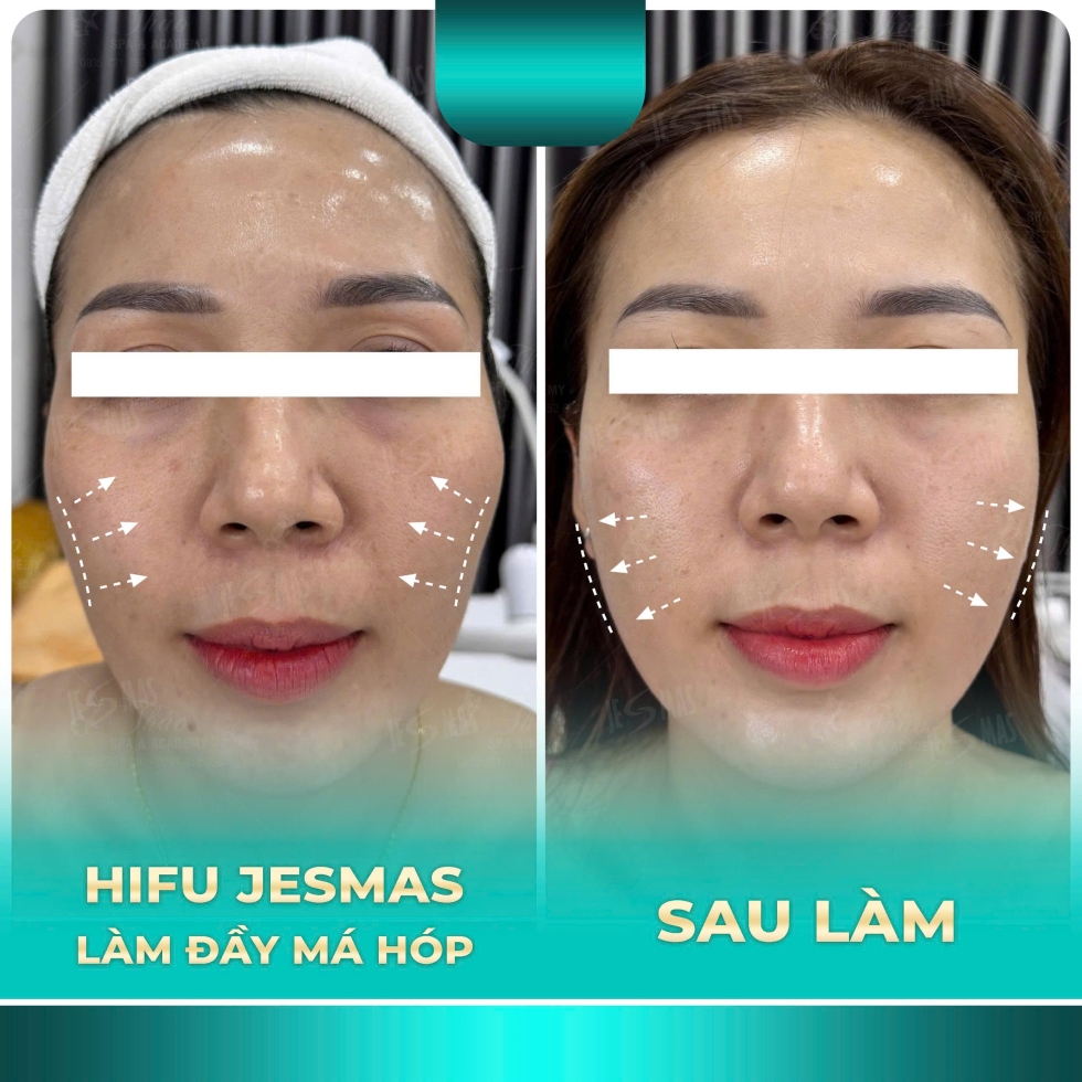 hifulamdaymahopxanhnhat2
