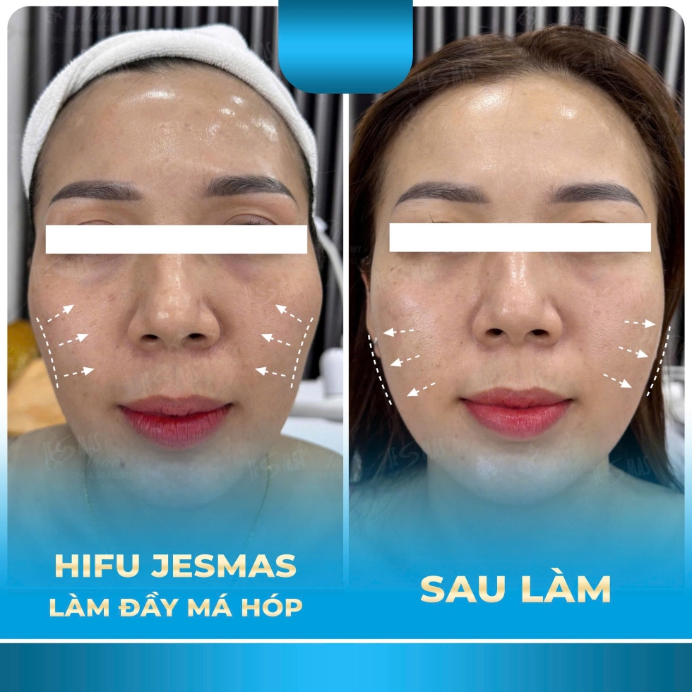 hifulamdaymahopxanhnhat